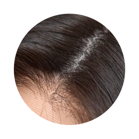 silk-top-wigs-collection-bubble.png