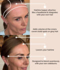 hairline-topper-before-after-2 (MADE TO ORDER) Hairline topper