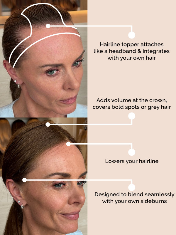 (MADE TO ORDER) Hairline topper 13 (MADE TO ORDER) Hairline topper