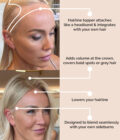 made to order hairline topper 2 before after made to order hairline topper 2 before after