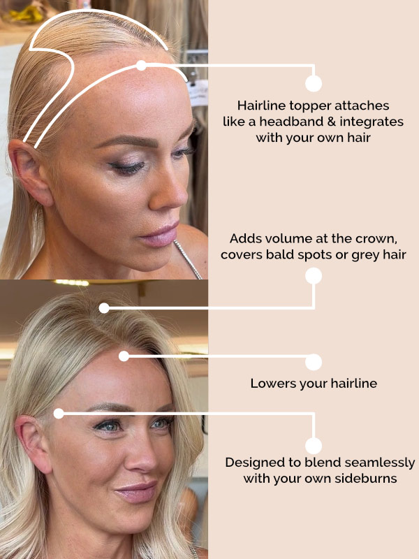 (MADE TO ORDER) Hairline topper 16 made to order hairline topper 2 before after